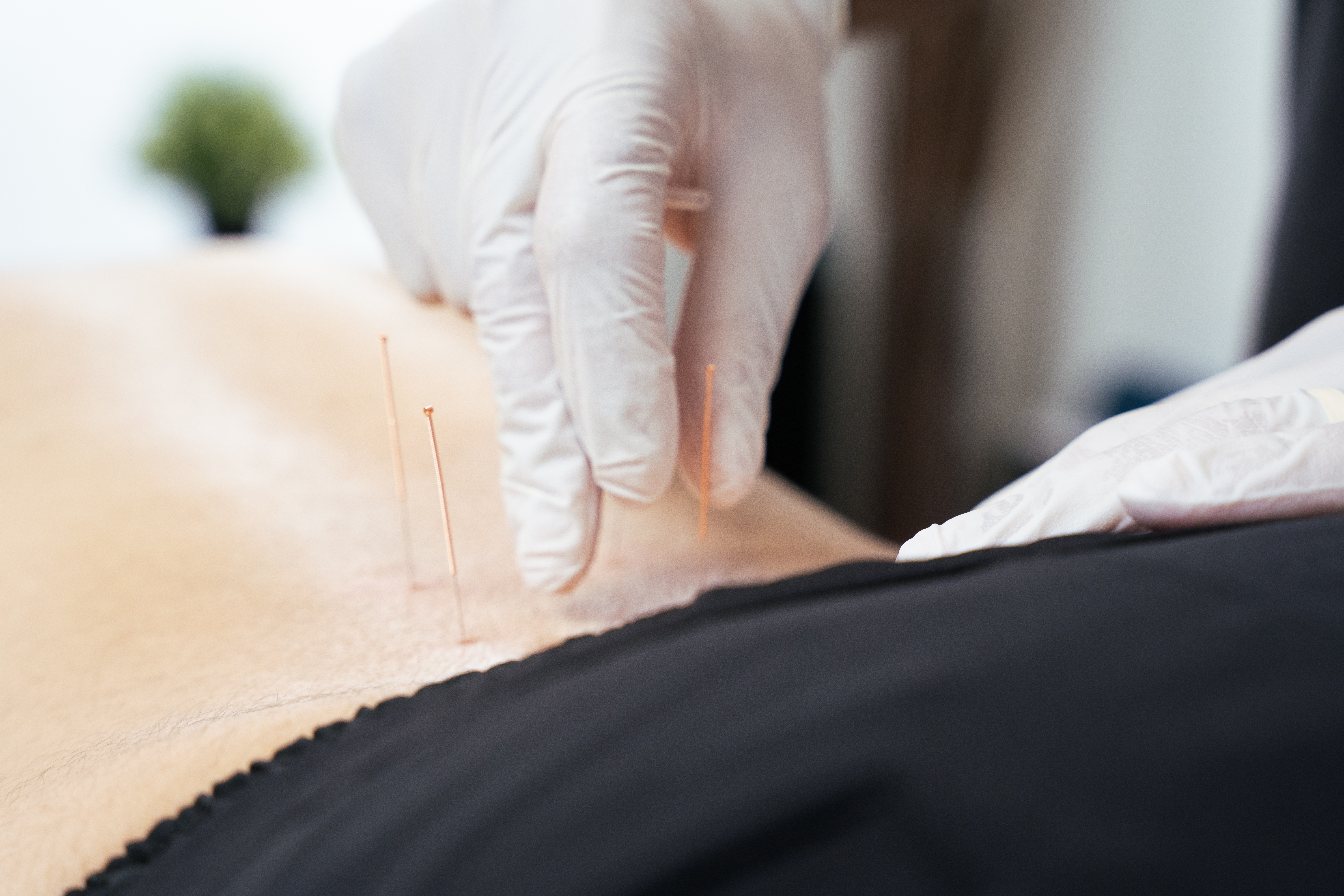 naturopathic medicine